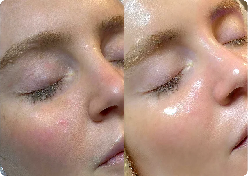 Patient Result 1