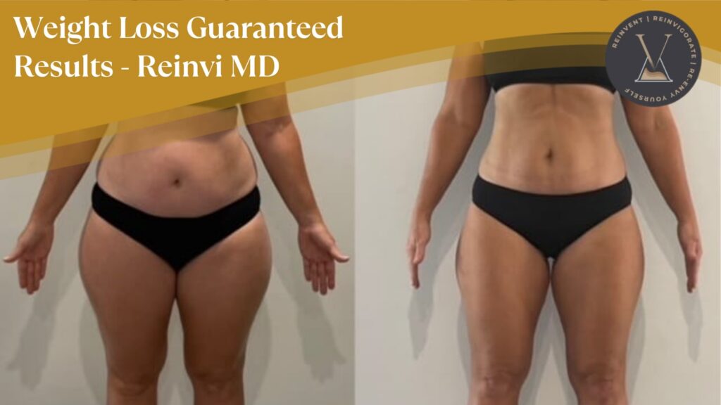 Why Reinvi MD Delivers Weight Loss Guaranteed Results