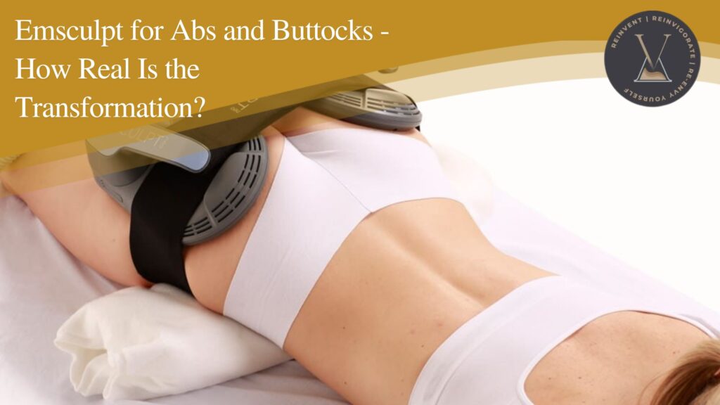Emsculpt for Abs and Buttocks