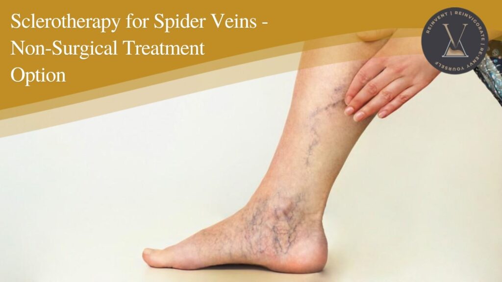 Sclerotherapy for Spider Veins