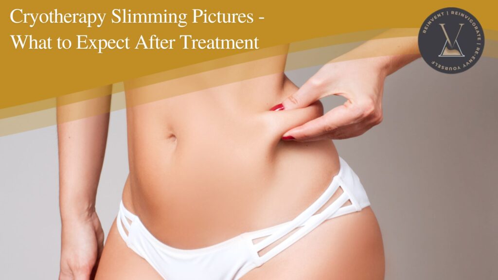Cryotherapy Slimming Pictures