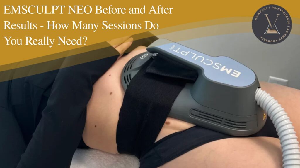 EMSCULPT NEO before and after
