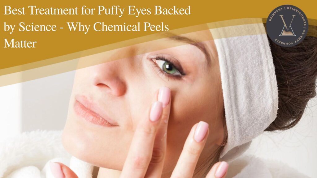 Best Treatment for Puffy Eyes