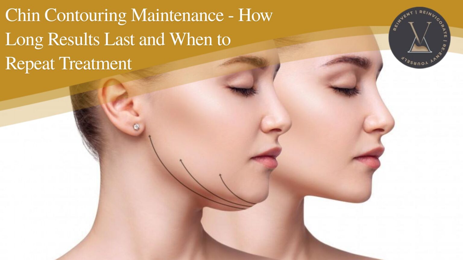 Chin Contouring Maintenance: How to Make Results Last